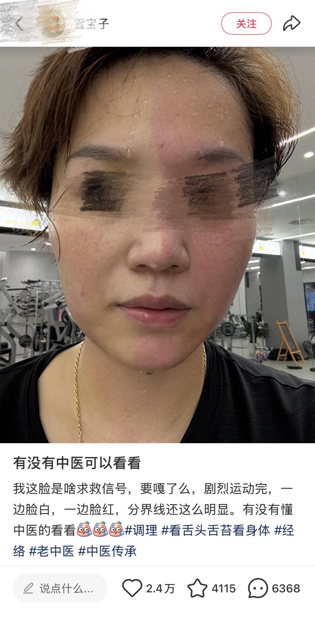 或是罕见病, class